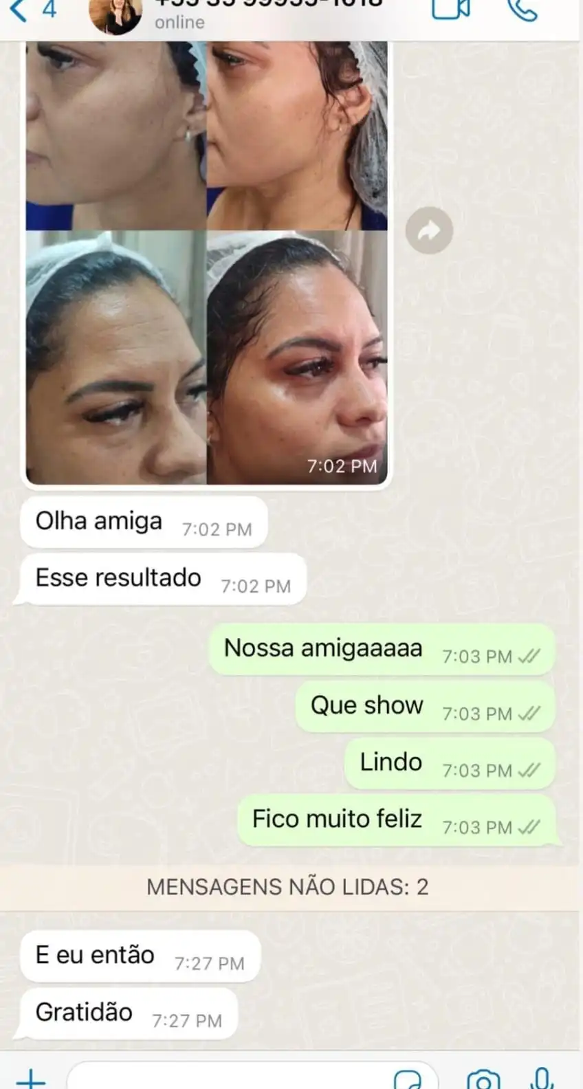 Depoimento aluna 4